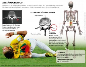 Fratura Neymar